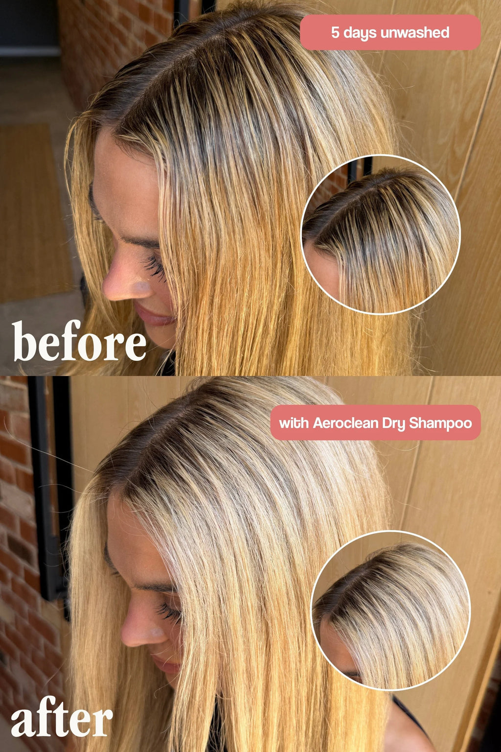 VANI-T Aeroclean Dry Shampoo with Hair Growth Complex