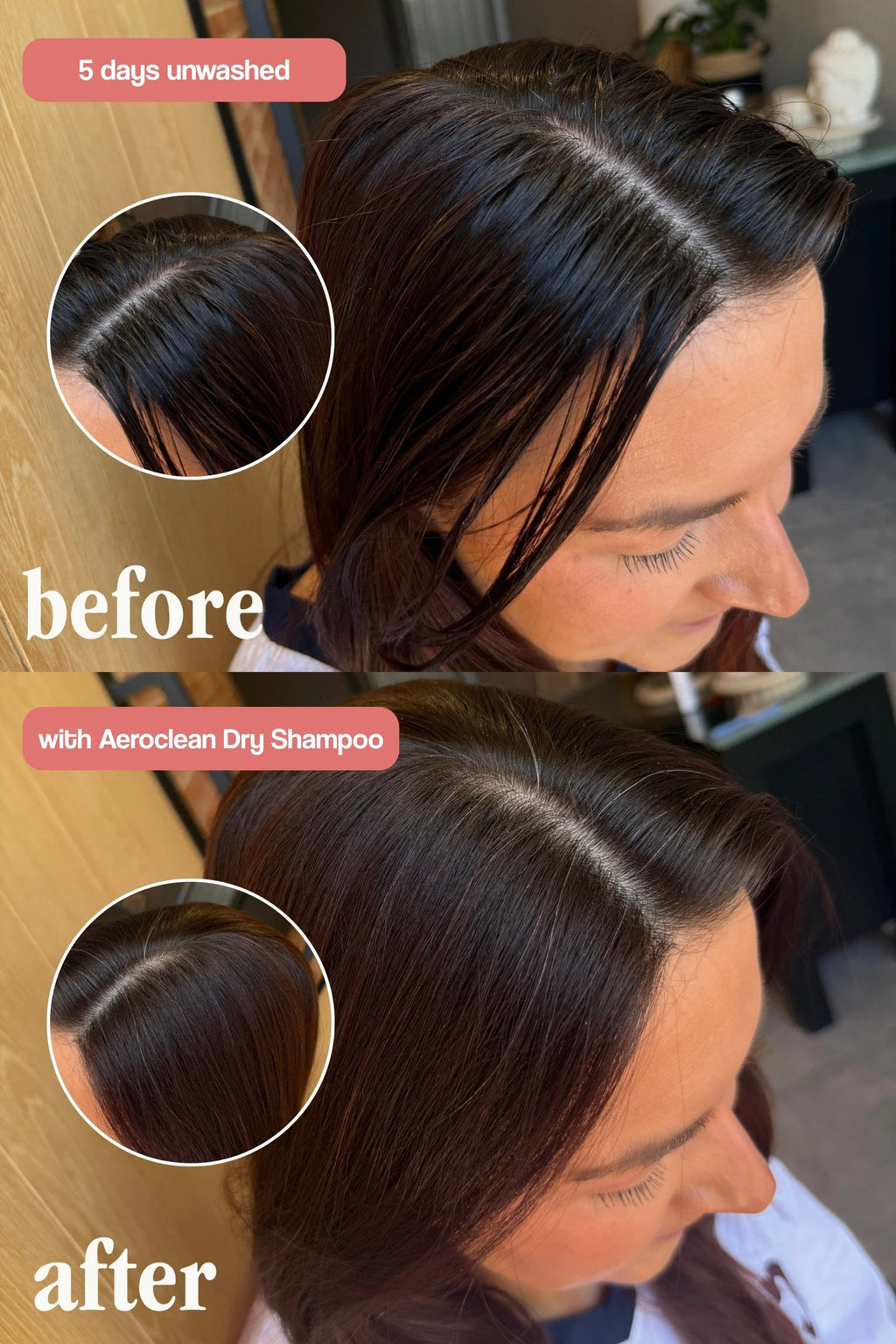 VANI-T Aeroclean Dry Shampoo with Hair Growth Complex