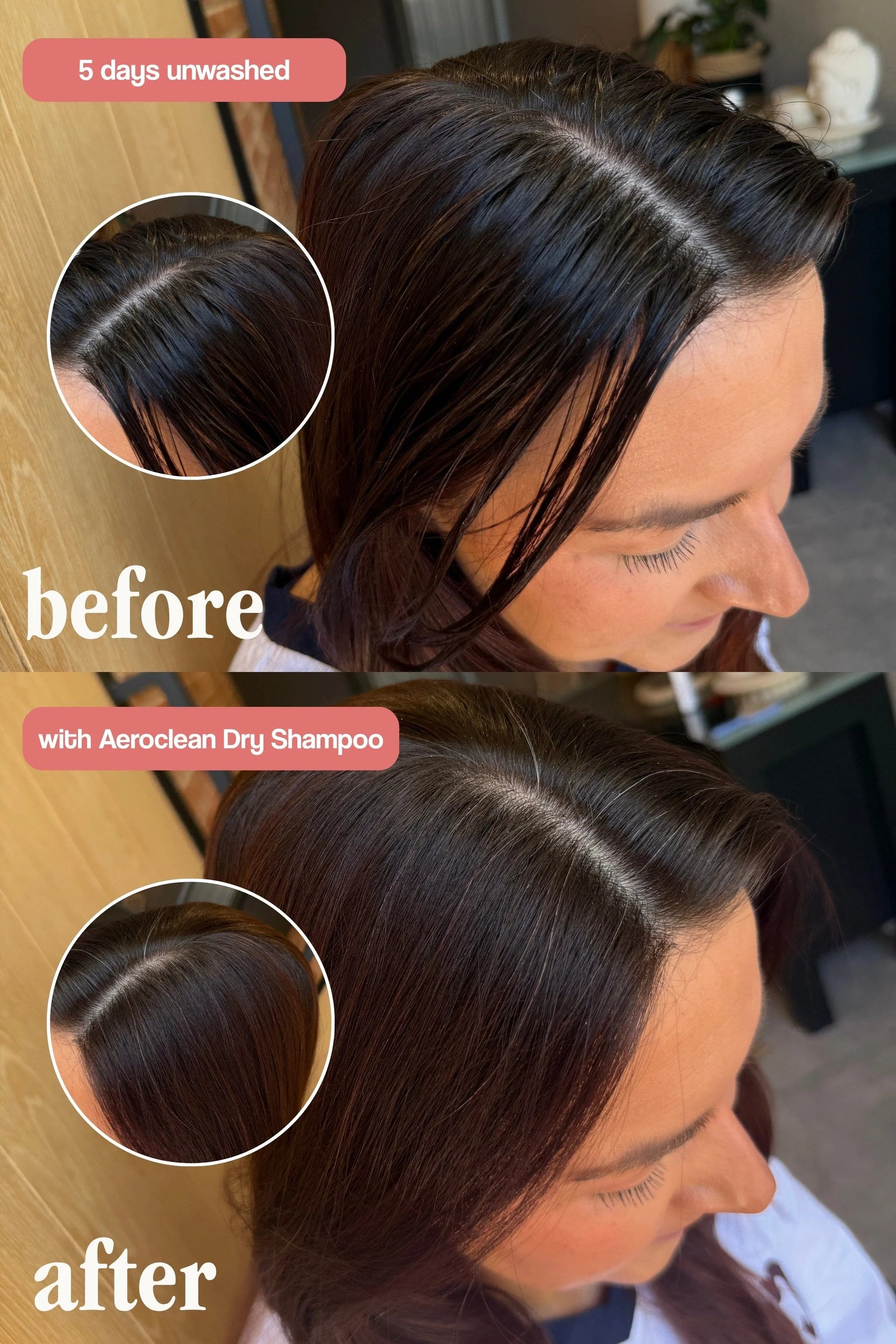 VANI-T Aeroclean Dry Shampoo with Hair Growth Complex