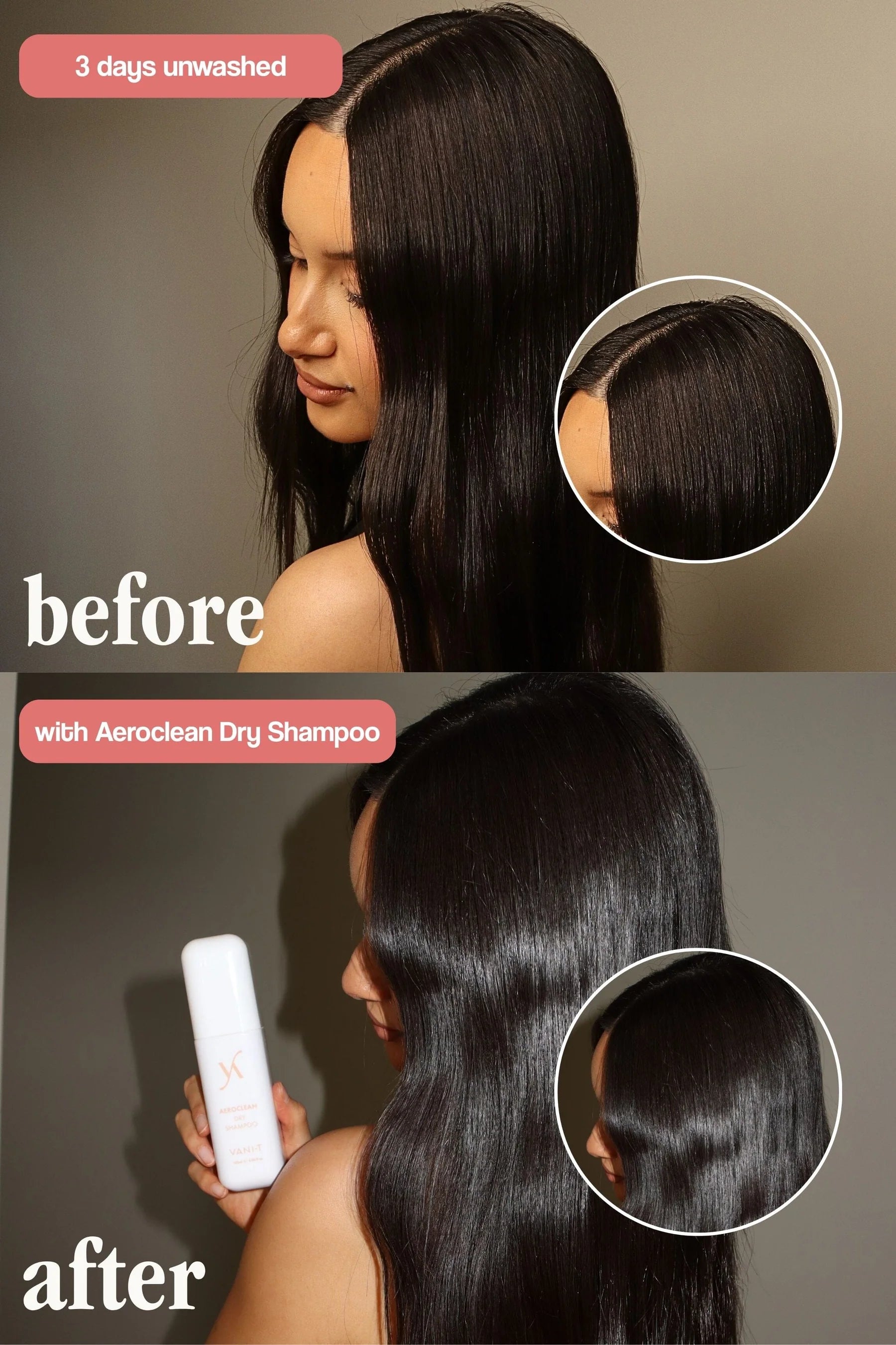 VANI-T Aeroclean Dry Shampoo with Hair Growth Complex