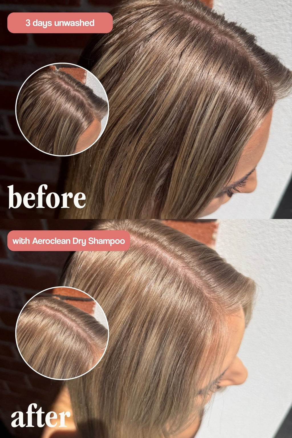 VANI-T Aeroclean Dry Shampoo with Hair Growth Complex