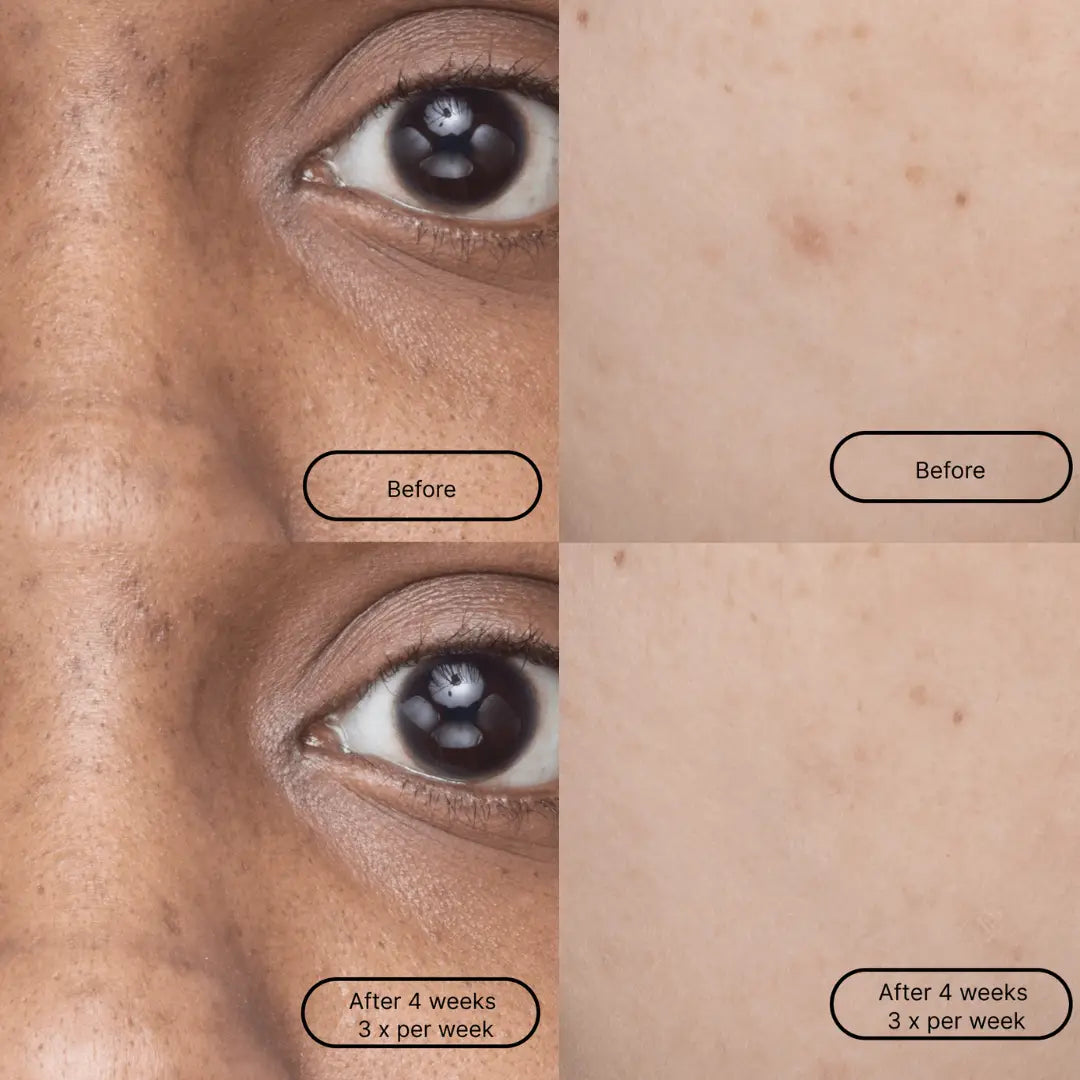 LOOPS Weekly Reset Dark Spot Single Sheet Mask showing the sheet mask soaked in serum, designed for brightening and dark spot reduction.